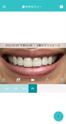 セルフィー